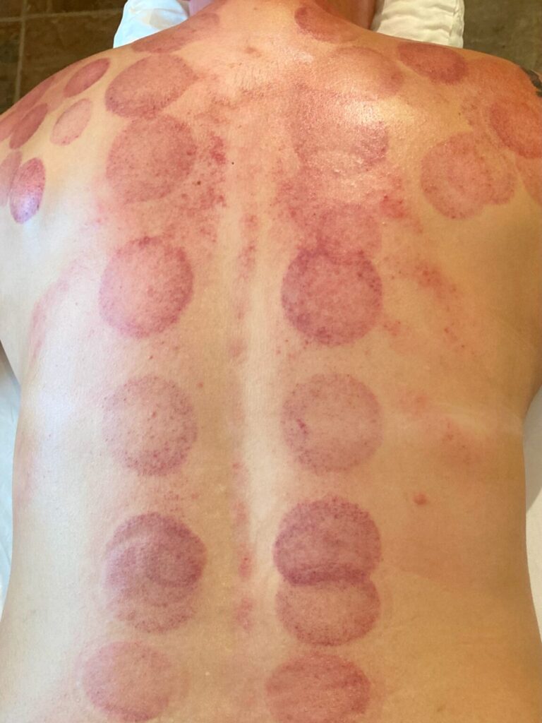 Chinese Bodywork Therapy in St. Petersburg, Florida