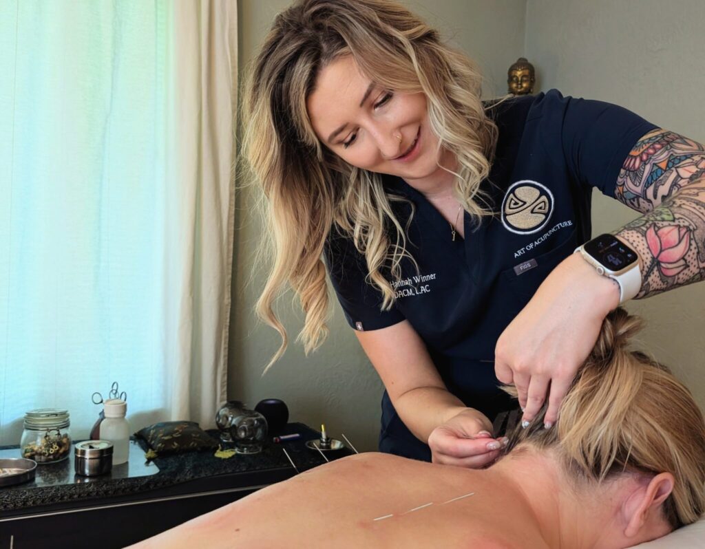 Acupuncture and Medicine for General Health in St. Petersburg, FL