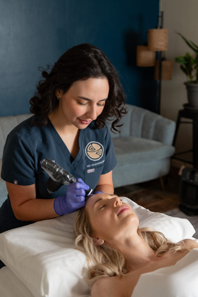 Katie Gibran - Art of Acupuncture’s Microneedling in St. Petersburg, FL