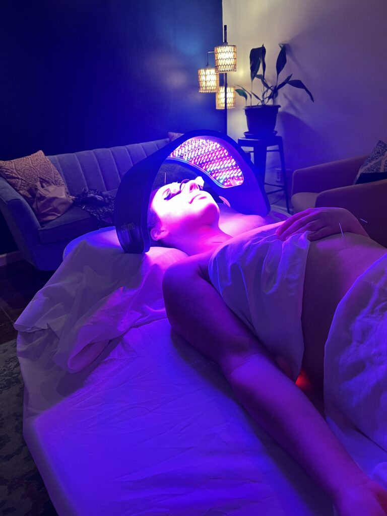 Red Light Therapy at Art of Acupuncture